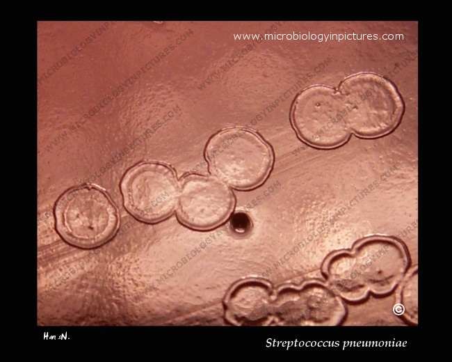 autolyzed colonies of pneumococcus